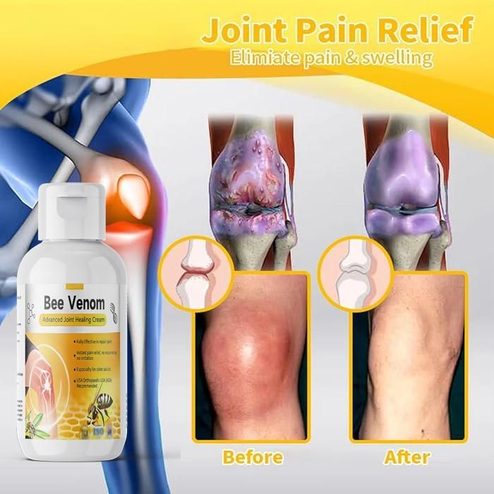 Bee Venom Advanced Joint Healing Cream 200 gm Pack of 1