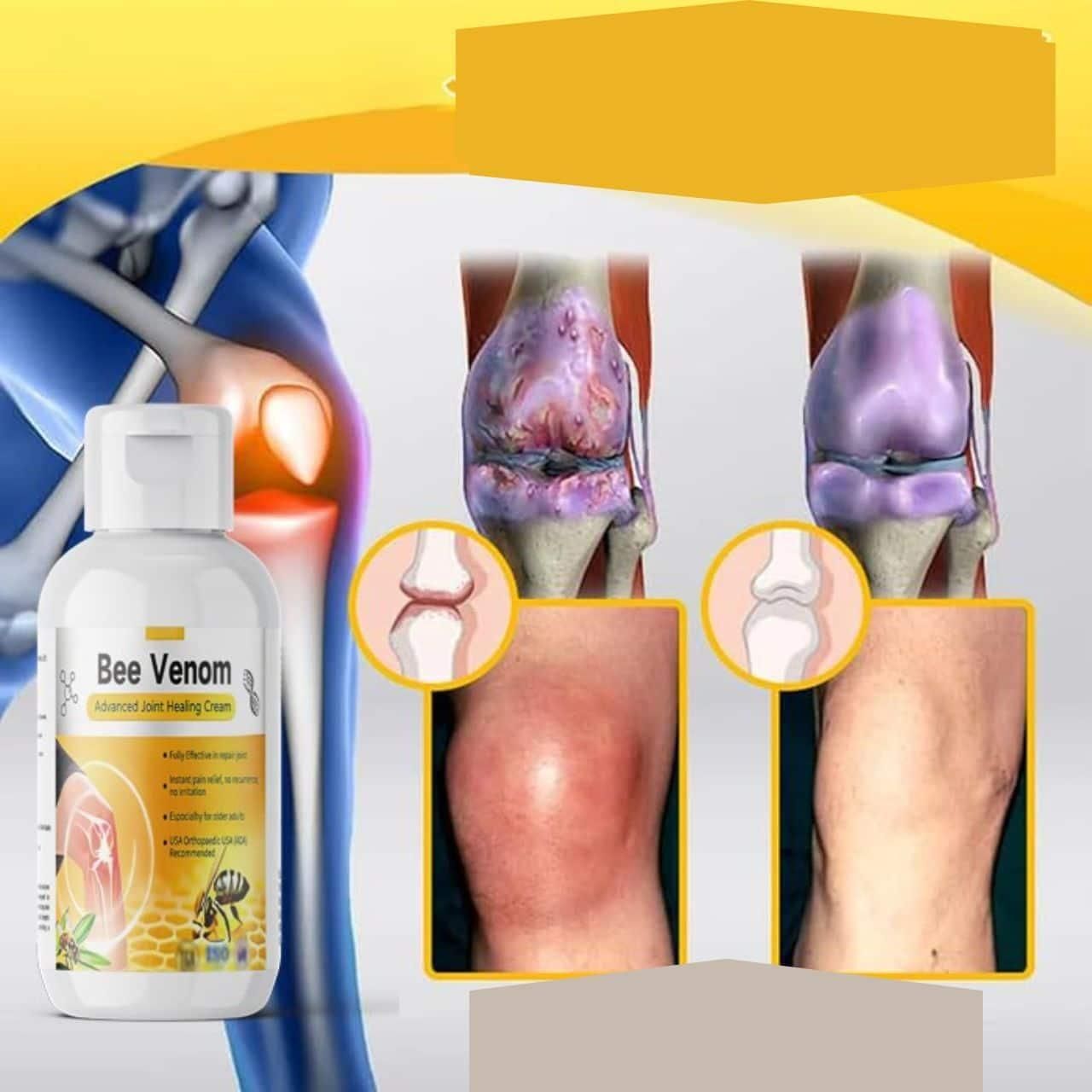 Bee Venom Advanced Joint Healing Cream 200 gm Pack of 1